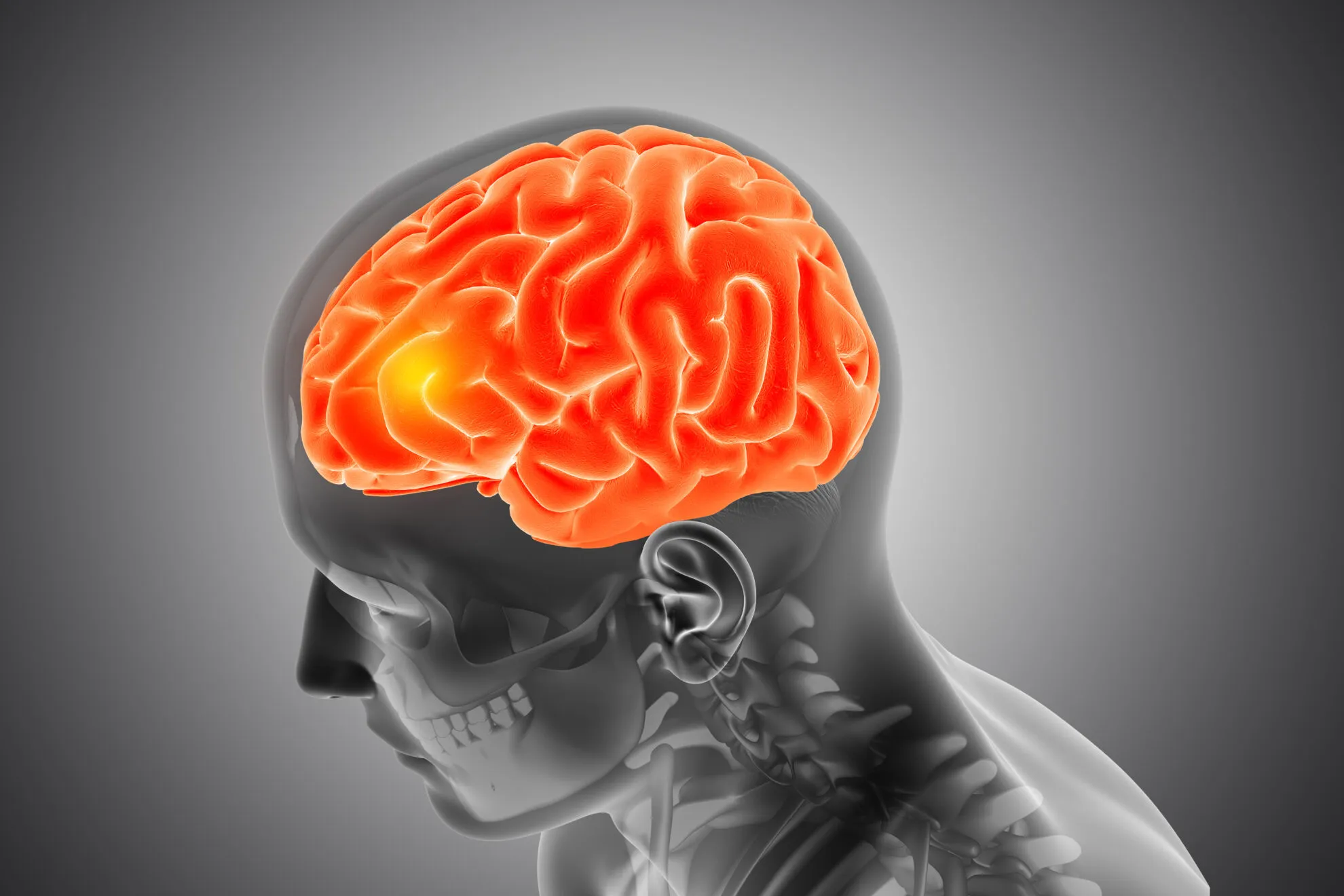 INTRACTABLE PAIN MANAGEMENT REQUIRES COUNTERING SPINAL AND BRAIN INFLAMMATION