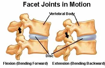 Facet Joints in Motion - Facet Joint Disorder