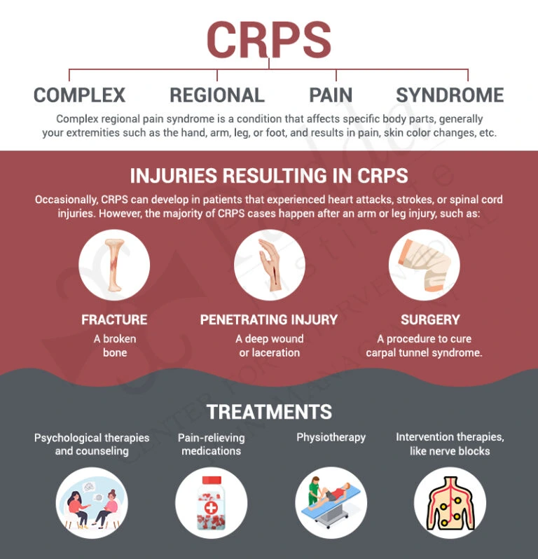 Complex Regional Pain Syndrome Treatment