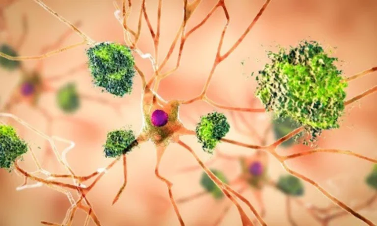 Microscopic illustration of neurons and immune cells