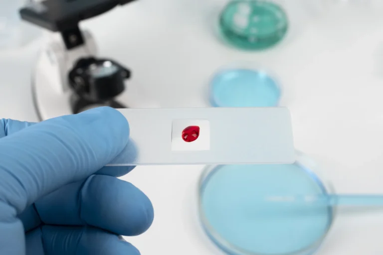 Gloved hand holding a blood sample slide beside laboratory dishes