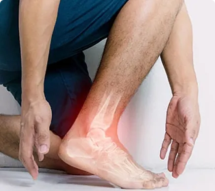 Serious Foot Pain