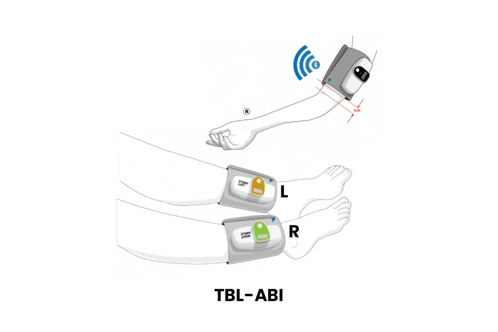 Ankle Brachial Index & Volume Plethysmography