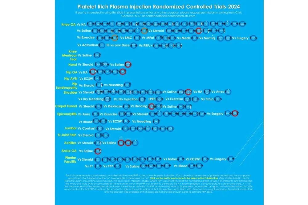 Platelet rich Plasma
