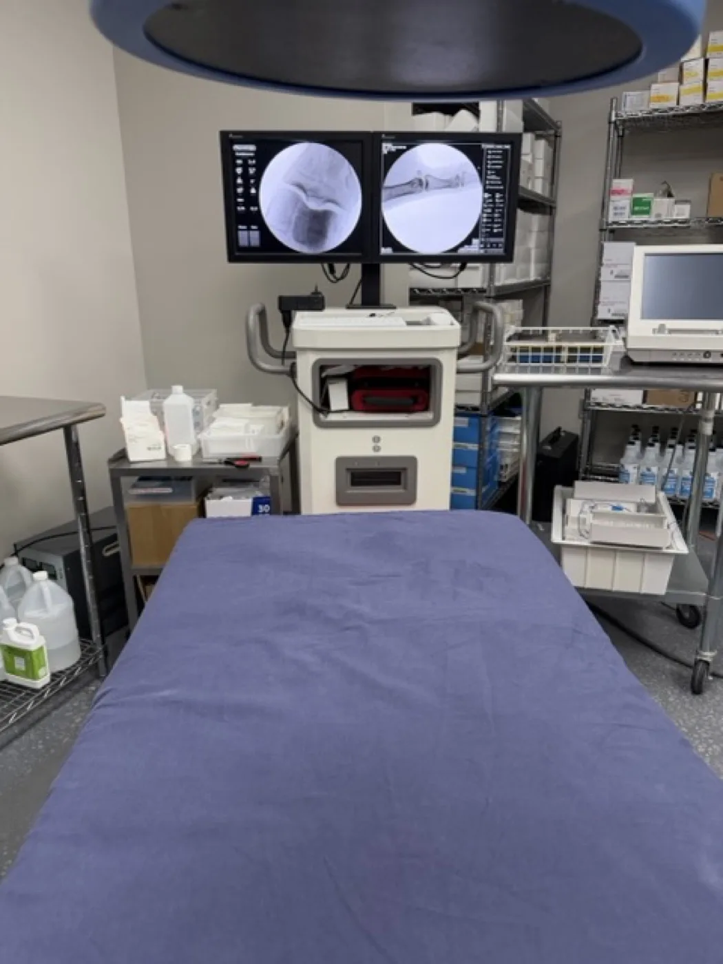 Fluoroscopy procedure room with imaging monitors above a prepared procedure table, at Padda Institute, 4477 Woodson Road, St. Louis, MO 63134
