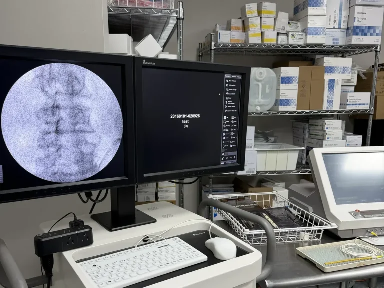 Fluoroscopic image of the lumbar spine during a guided sympathetic chain injection