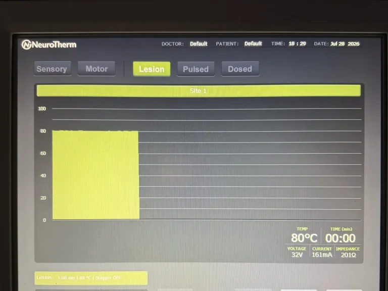 Procedure suite console at the completion of a radiofrequency treatment cycle