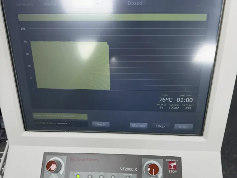 Radiofrequency generator in the procedure suite between treatment cycles