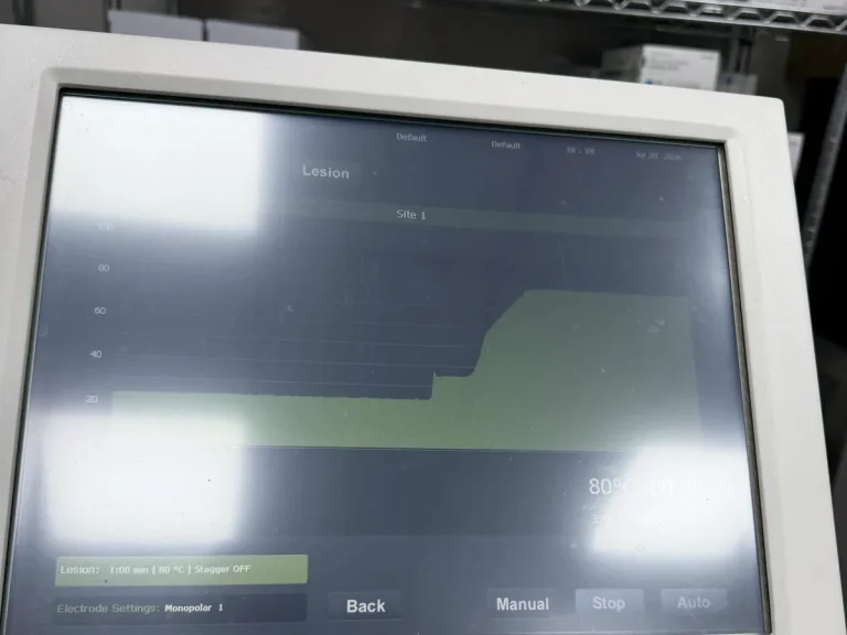 Radiofrequency generator ramping up at the start of a treatment cycle