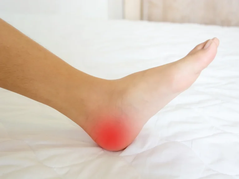 A bare foot and ankle resting on a bed with the underside of the heel highlighted