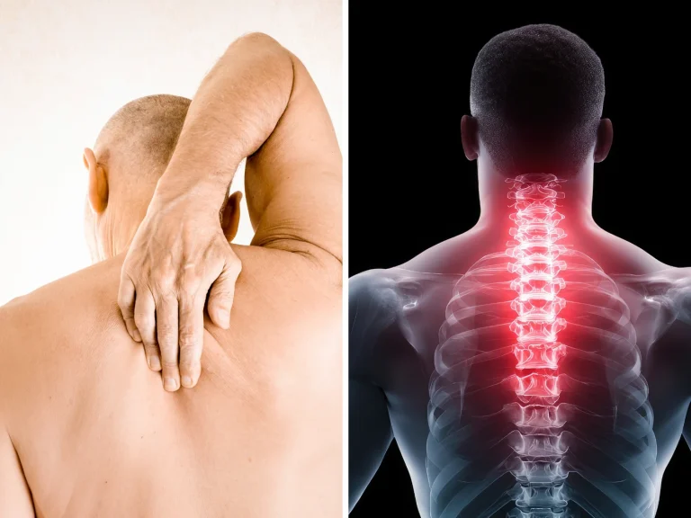 A person reaching over the shoulder to press between the shoulder blades, beside an anatomical render of the upper back with the thoracic spine and ribs highlighted