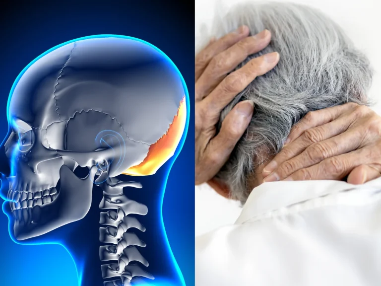 Lateral skull illustration with the occipital region highlighted, beside a person holding the back of the head and upper neck with both hands