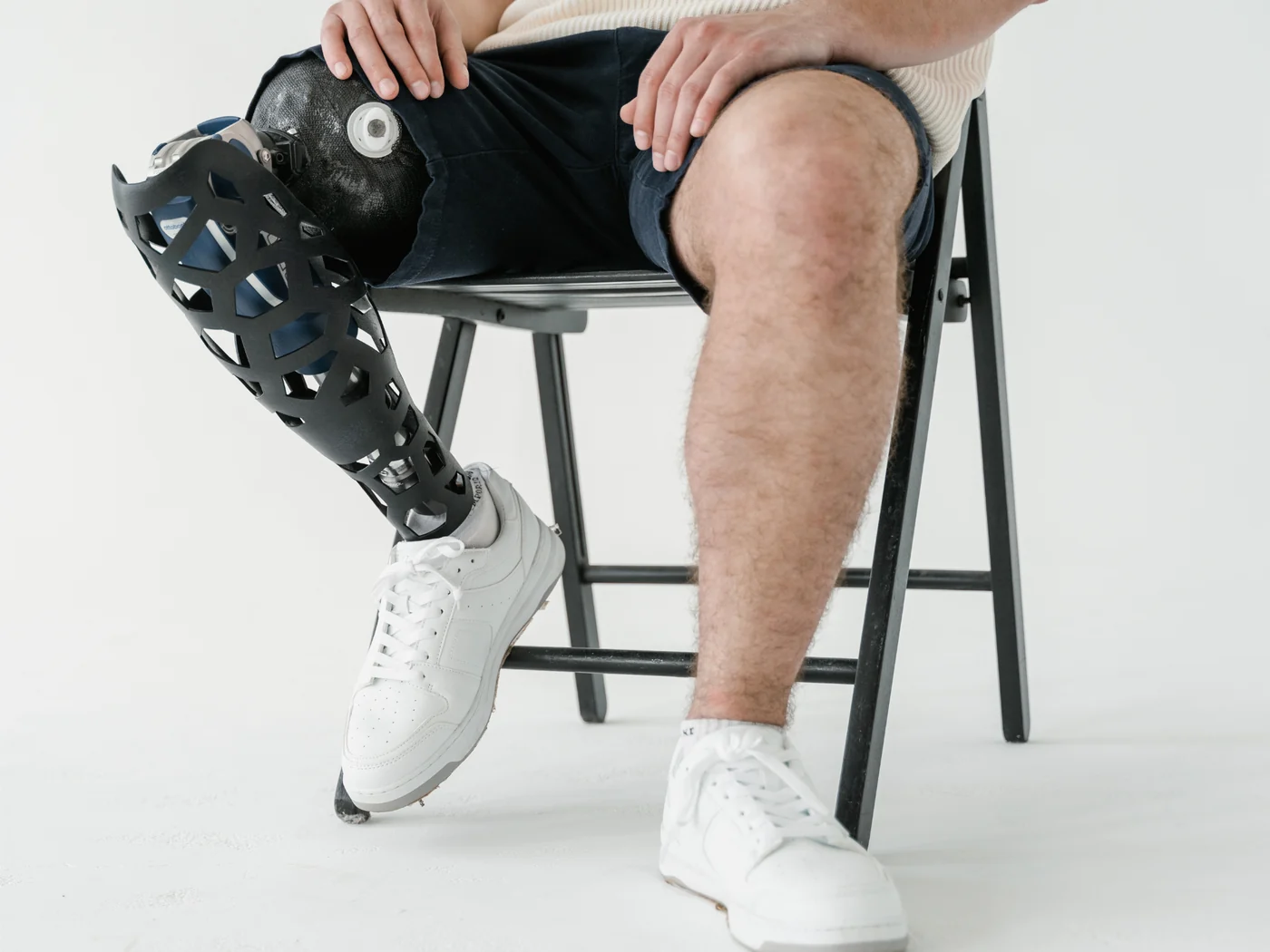 A person seated on a stool adjusting a below-knee prosthesis