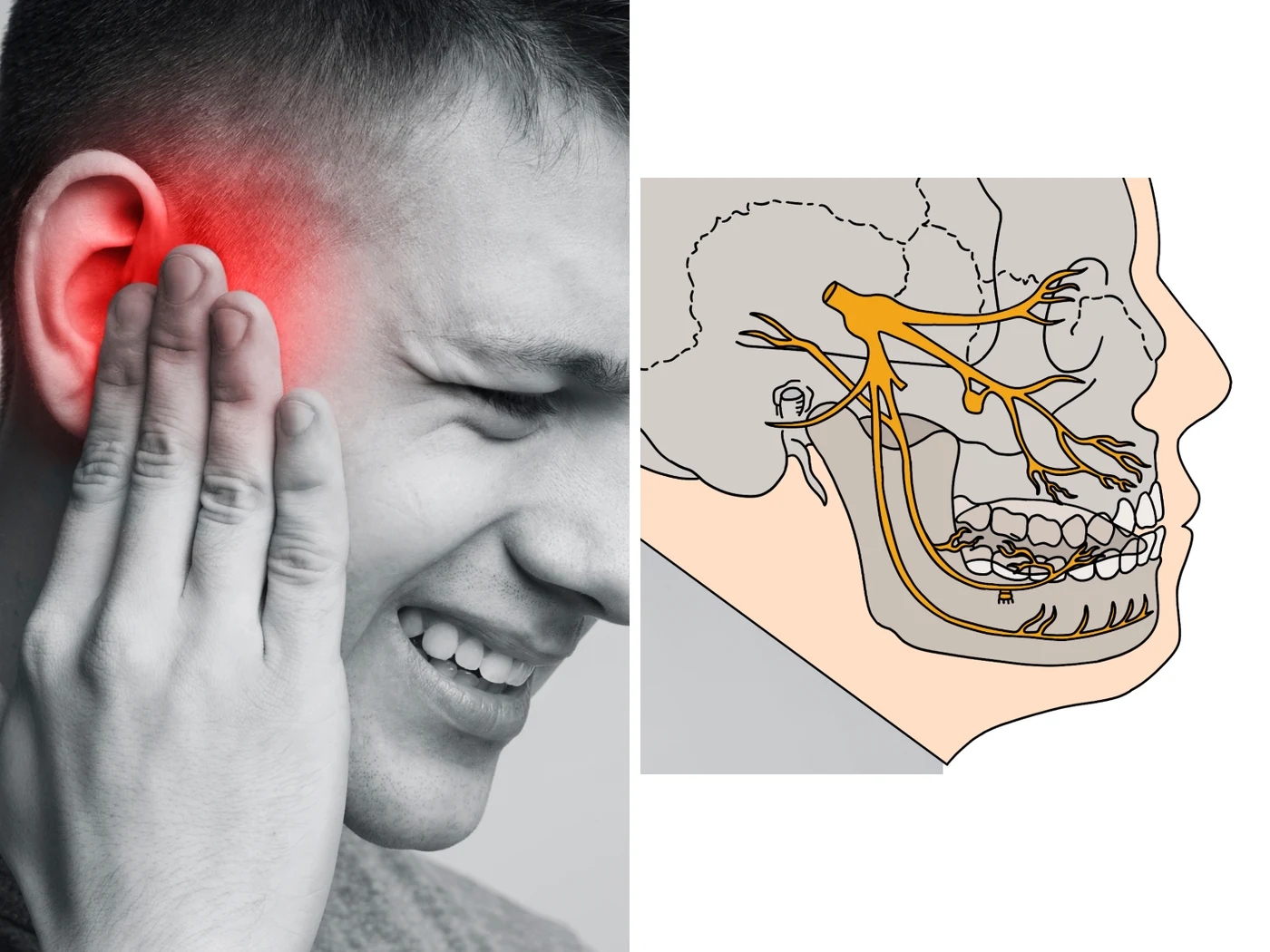 A person holding one side of the face near the jaw beside an anatomical diagram of the trigeminal nerve, showing the ganglion and its ophthalmic, maxillary and mandibular divisions