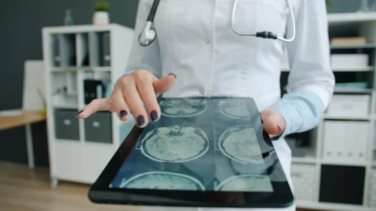 Brain scan images displayed on a tablet held by a clinician