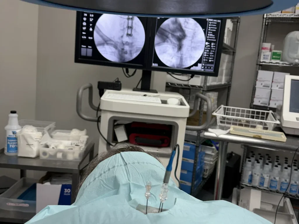Fluoroscopy monitors above a draped patient during an image-guided cervical procedure at Padda Institute, St. Louis